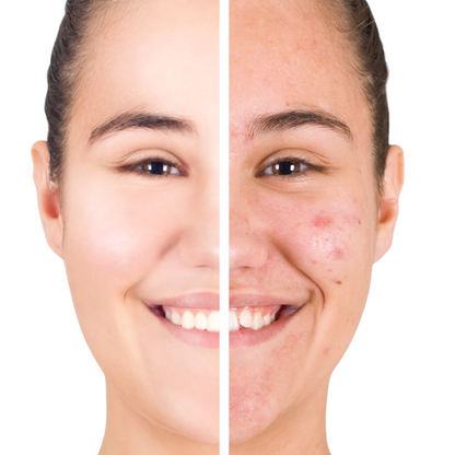 Rejuvenating Anti-Acne Organic Facial Scrub