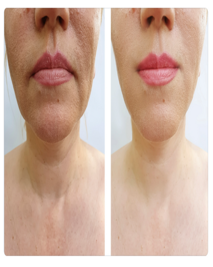 ORGANIC NECK RENEWAL CREAM - For Women